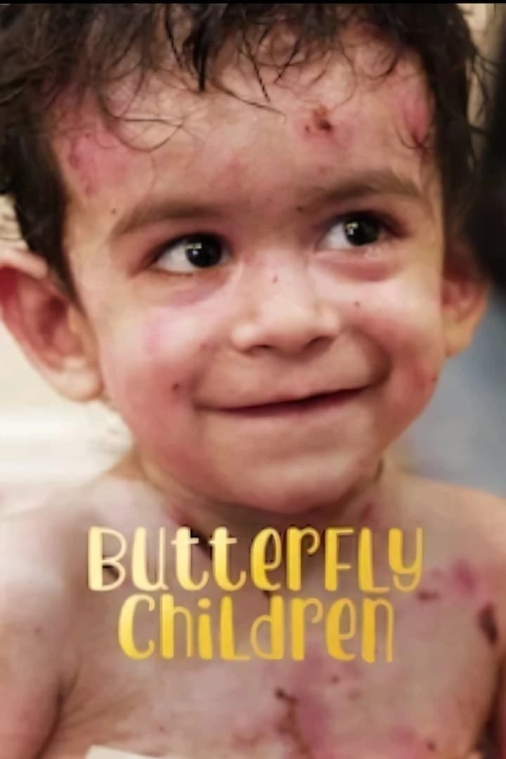 Xem phim Những đứa trẻ da cánh bướm - Butterfly Children