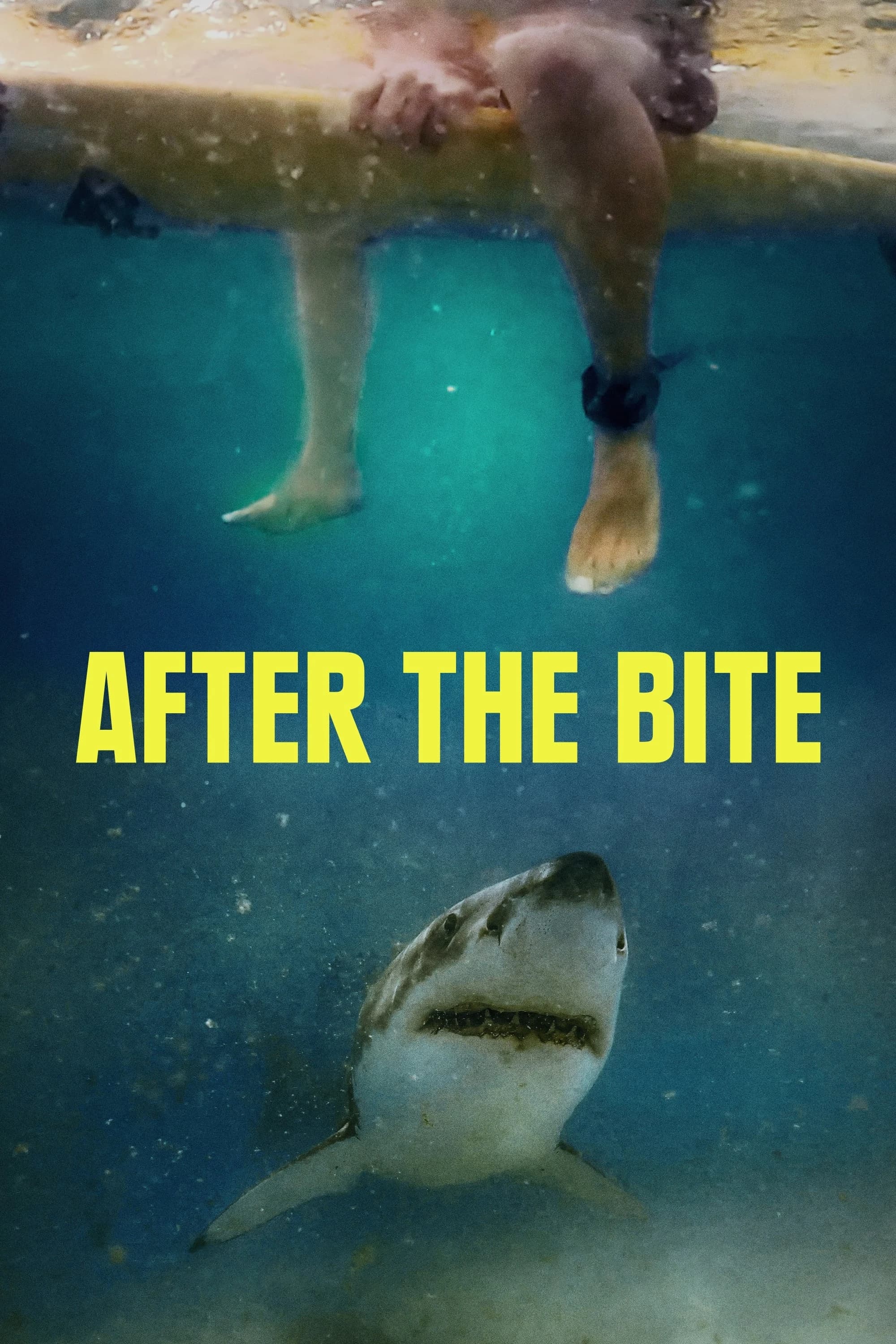 Xem phim Sau Cú Đớp - After the Bite
